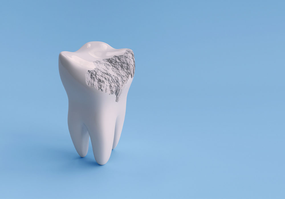 早期治療と再発防止で歯へのダメージを抑える
