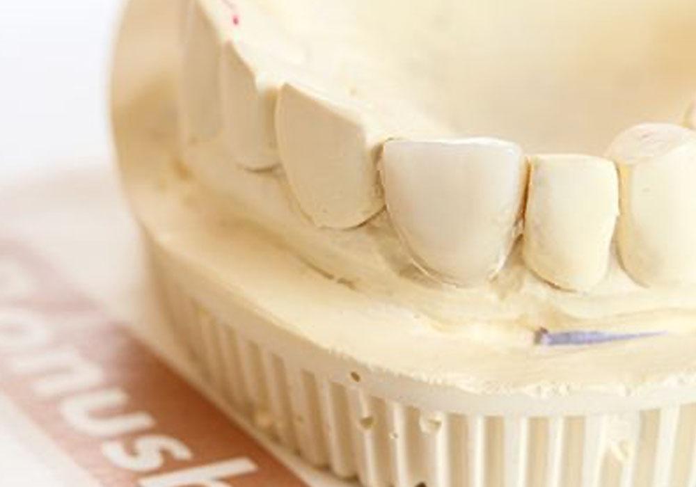 かみ合わせの調整