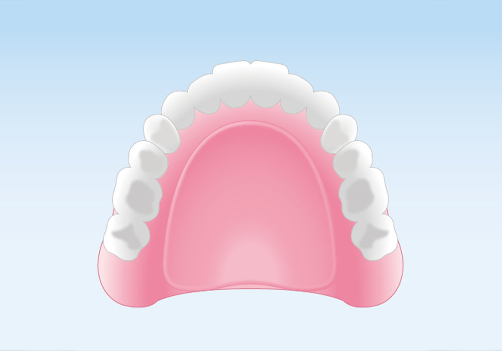 レジン床義歯（保険適用の総入れ歯）