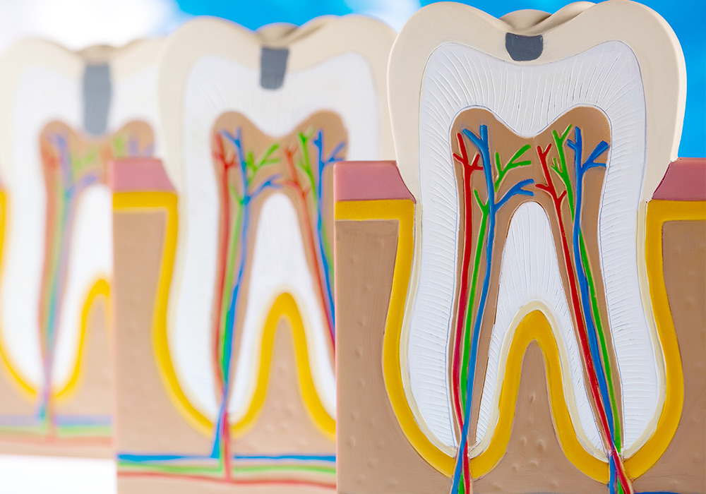 根管治療